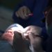 Choose the Right Oculoplastic Surgeon in Vadodara
